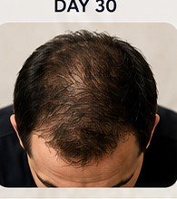 Day 30 Results