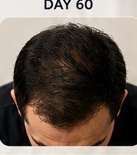 Day 60 Results